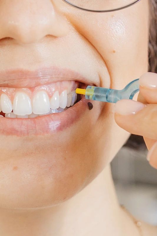 Мифы о домашнем отбеливании зубов: что нужно знать, прежде чем рисковать