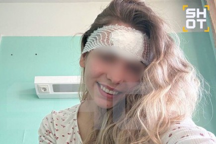 Не выдавливайте прыщи!. Жительница Котласа, 28-летняя Алина, оказалась в больнице после попытки самостоятельно выдавить прыщ на лбу