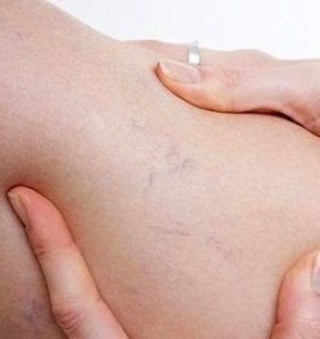 ����������� ������ ������ � ����������� ����������� �� �����