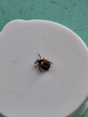 Житель Вельского округа рассказал о встрече с клещом